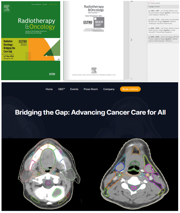 QSUNT kontribuon denjësisht në studimin Global mbi Potencialin e Inteligjencës Artificiale në trajtimin me Radioterapi të Tumoreve të Kokë – Qafës ”ELAISA”, krahas 98 pjesëmarrësve nga pesë kontinentet e globit